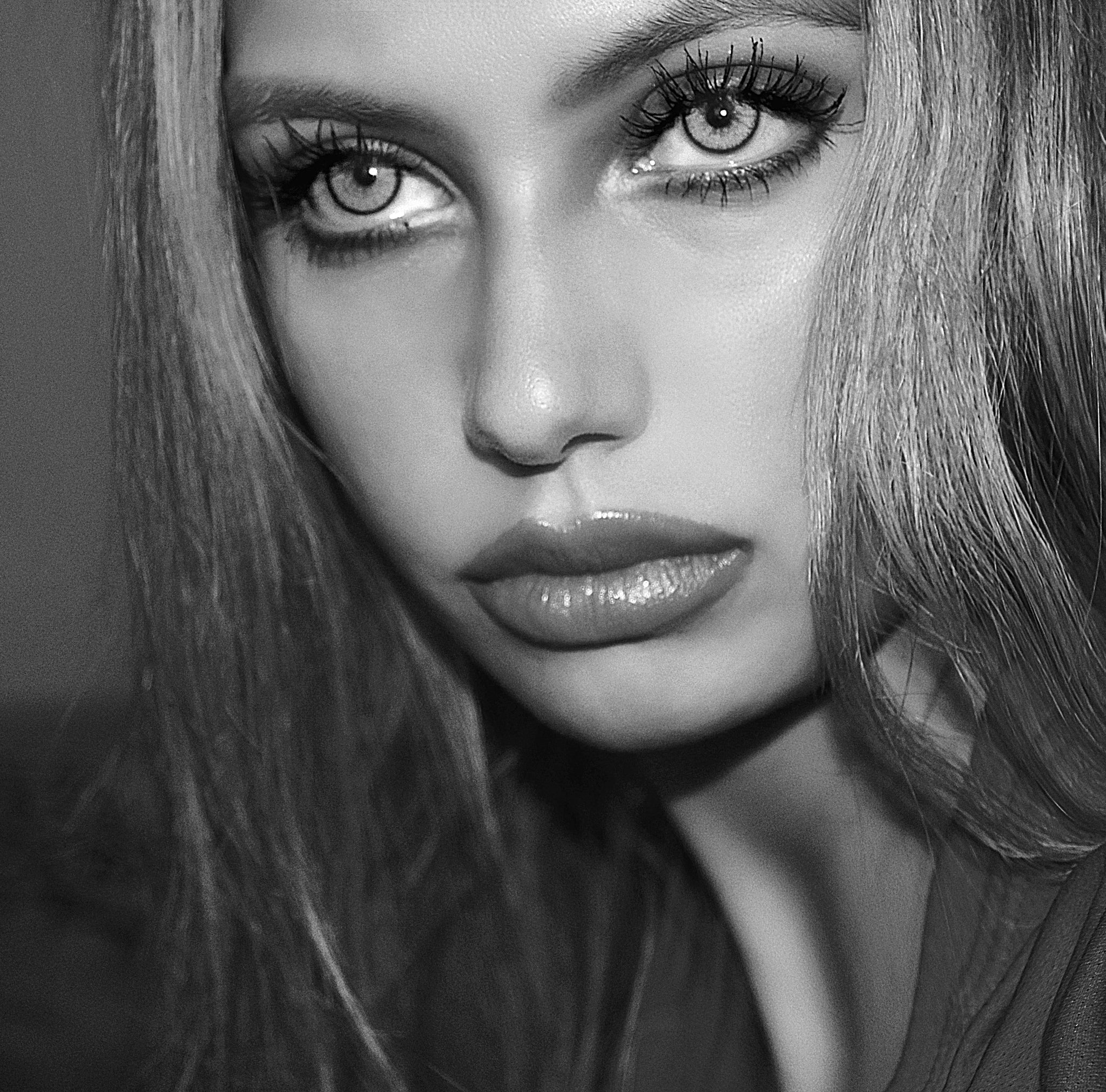 Lip fillers: What to expect and how to prepare